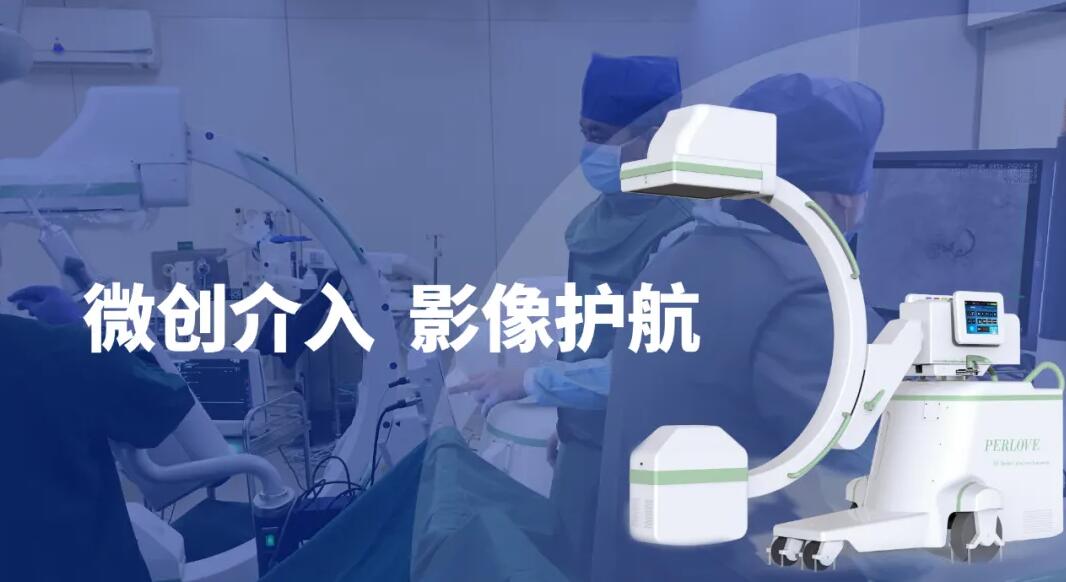 高清影像介入c臂機助力微創(chuàng)介入手術更成功