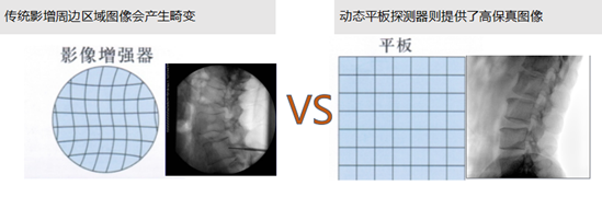 平板C臂 平板C臂