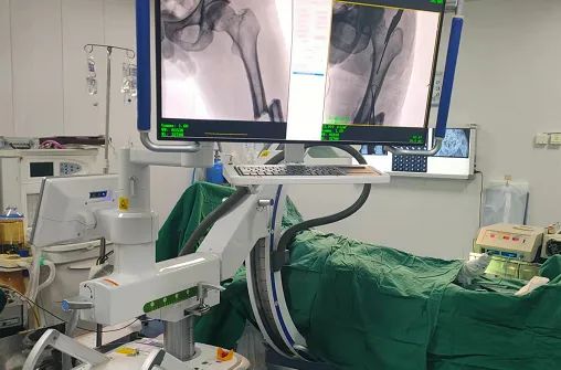 大平板一體式C形臂輔助手術過程 大平板一體式C形臂輔助手術過程